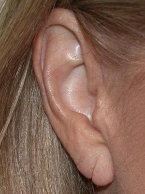 ear-1