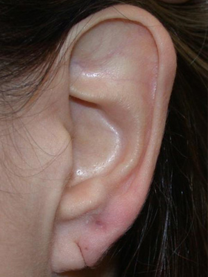 ear-1